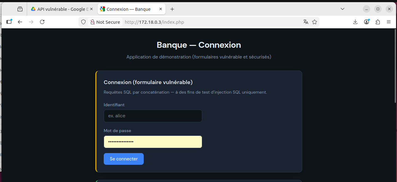 Aperçu — sécurisation d’API bancaire